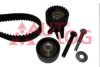 AUTLOG ZK1094 Timing Belt Kit